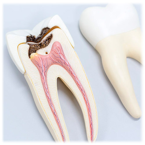 Terapia Dental